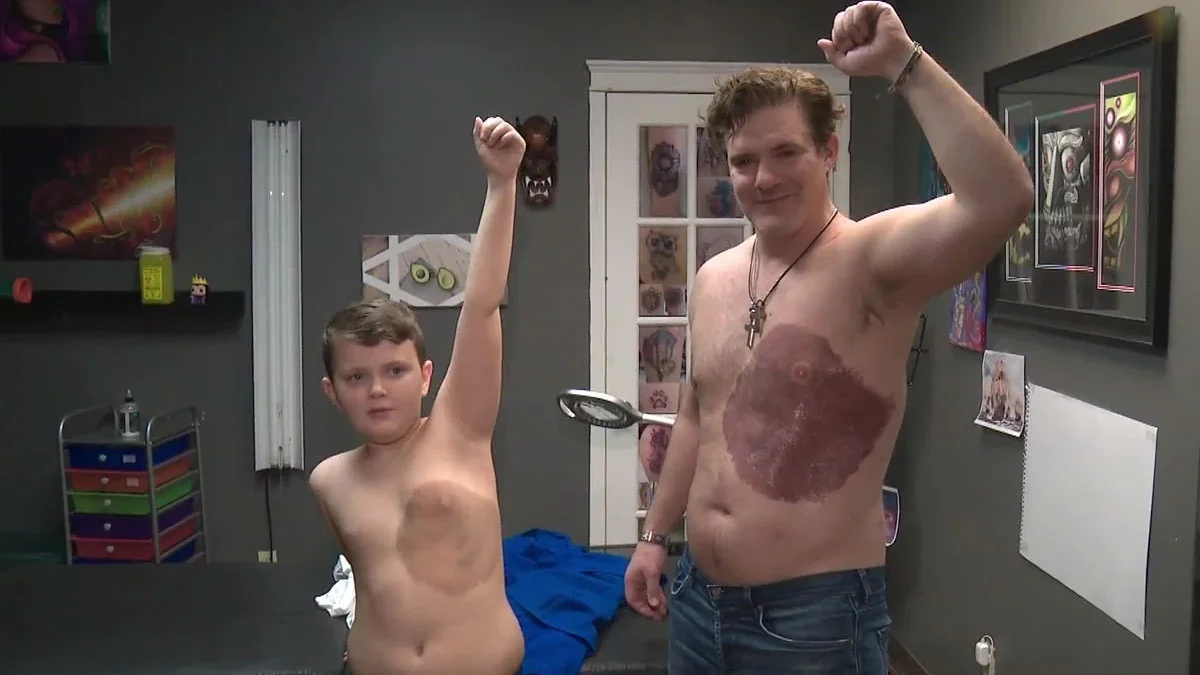 Aus Liebe zum Sohn: Vater bekommt das gleiche Muttermal als Tattoo