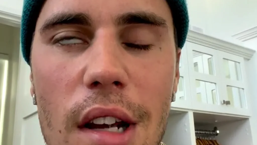 Gesundheitszustand immer schlechter: Justin Bieber veröffentlicht Schock-Video