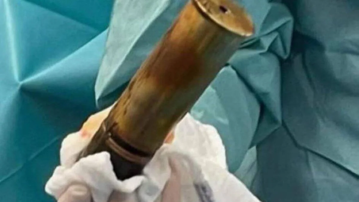 Granate im Po: 88-jähriger Franzose legt Krankenhaus lahm