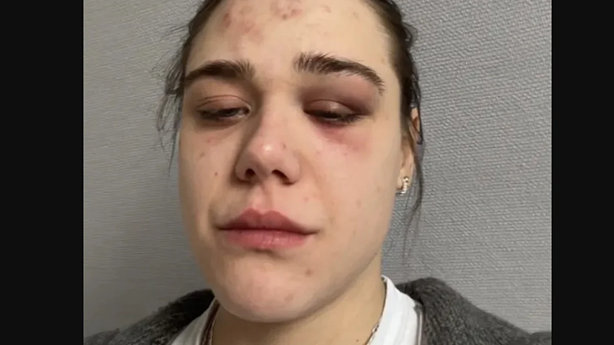 tiktok-star-auf-offener-strasse-zusammengeschlagen