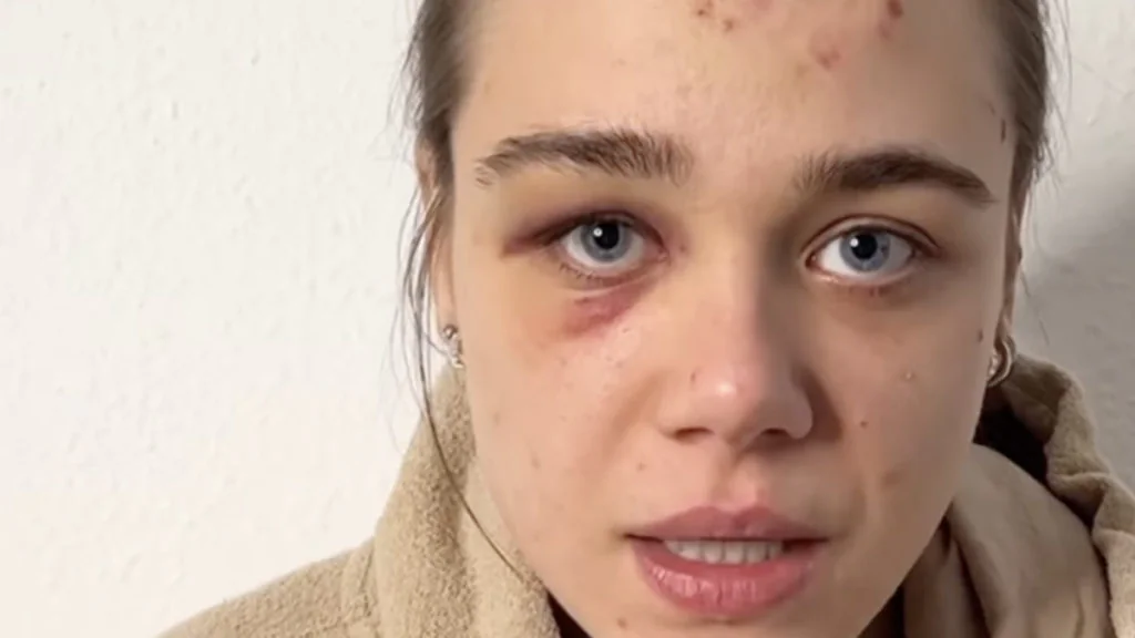 TikTok-Star auf offener Straße zusammengeschlagen
