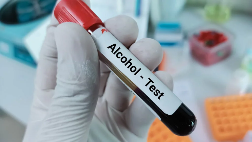 Alkohol: So lange kann man es im Blut nachweisen