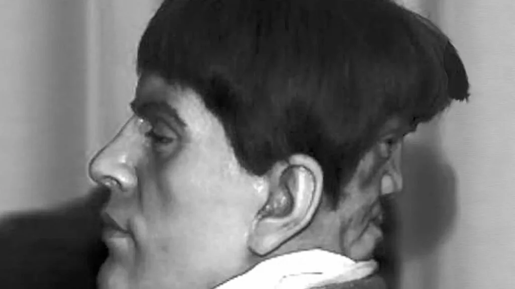 Edward Mordrake: Die furchtbare Geschichte über den Mann mit den zwei Gesichtern