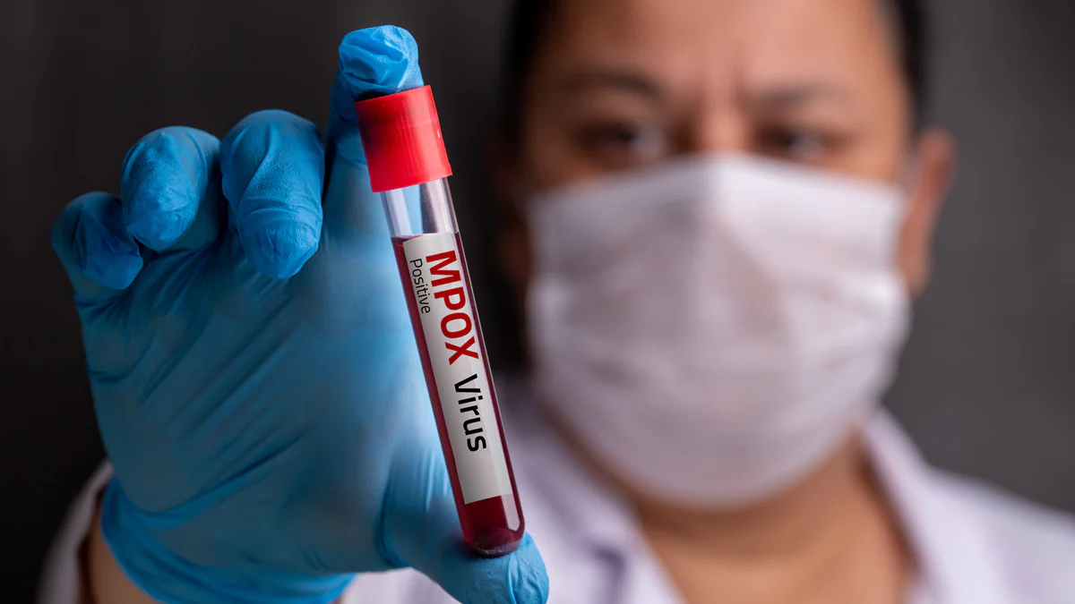 Neue Mpox-Variante erstmals in Deutschland nachgewiesen: Das sind die Symptome