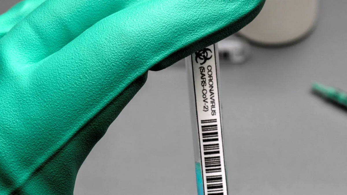 Jens Spahn: Kostenlose Corona-Schnelltests für alle Bürger