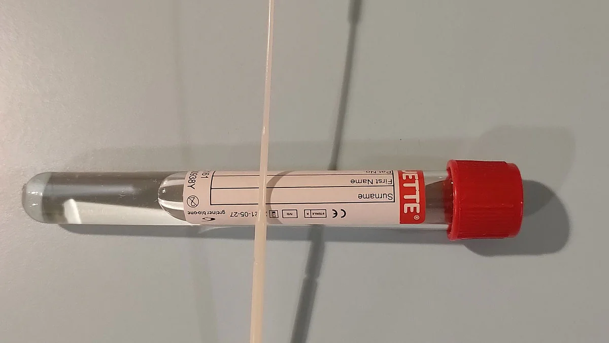 PCR-Test nutzlos: Neue Corona-Mutation in Frankreich entdeckt