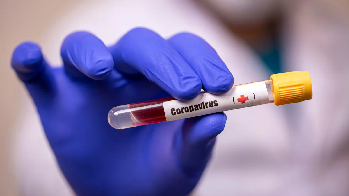 Corona: So gefährlich ist die Lambda-Variante