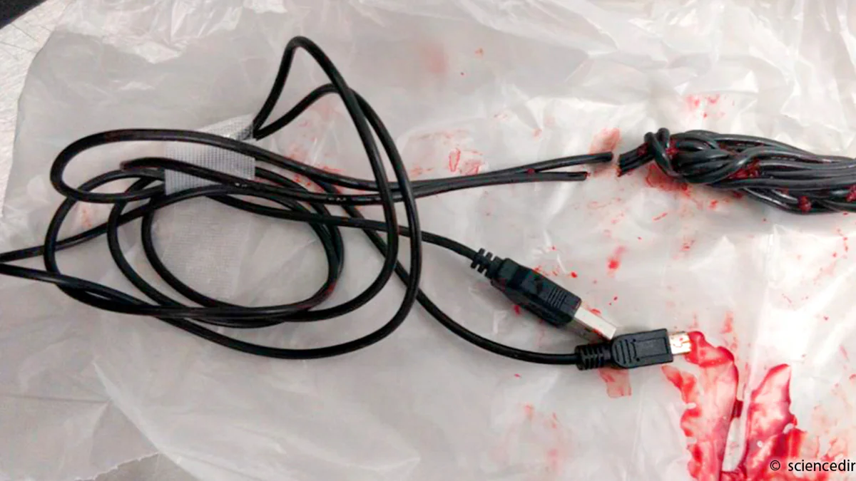 USB-Kabel in Penis geschoben: „Sexuelles Experiment“ endet im Krankenhaus