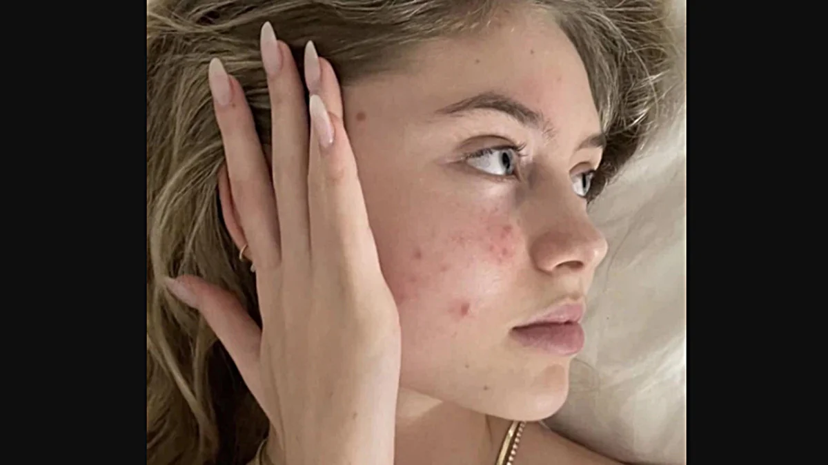 Model Leni Klum überrascht ihre Fans mit ehrlichem Foto