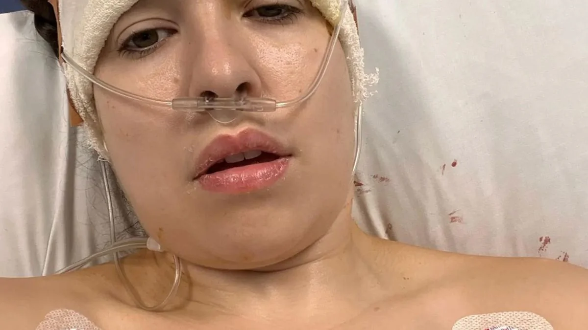Trotz Gehirn-OP: OnlyFans-Model postet verstörende Nacktbilder aus dem Krankenhaus