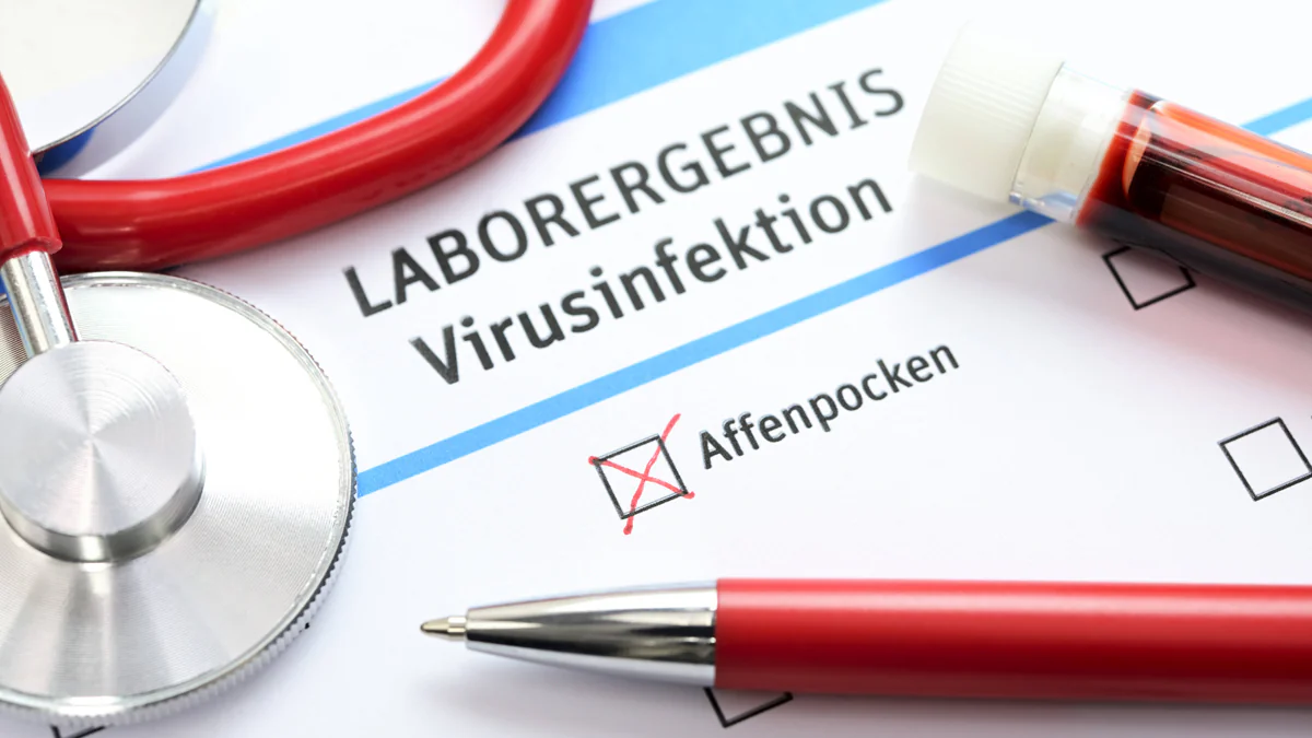 Affenpocken: Welche Personengruppen besonders gefährdet sind
