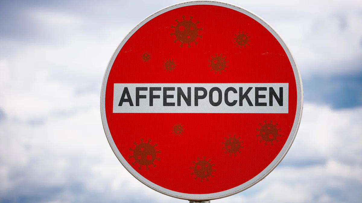 affenpocken-virus-verhaelt-sich-ungewoehnlich-who-erwaegt-gesundheitsnotstand
