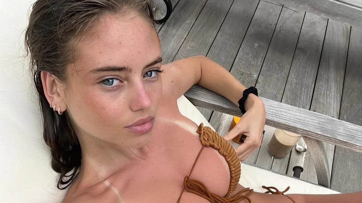 „Muss ja weh tun“: Leni Klum versetzt Fans mit Bikinibild in Sorge