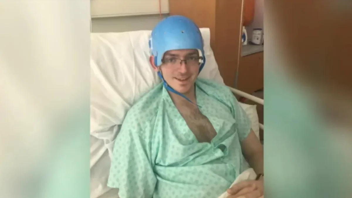 Nach Betriebsparty: Brite verliert halben Kopf