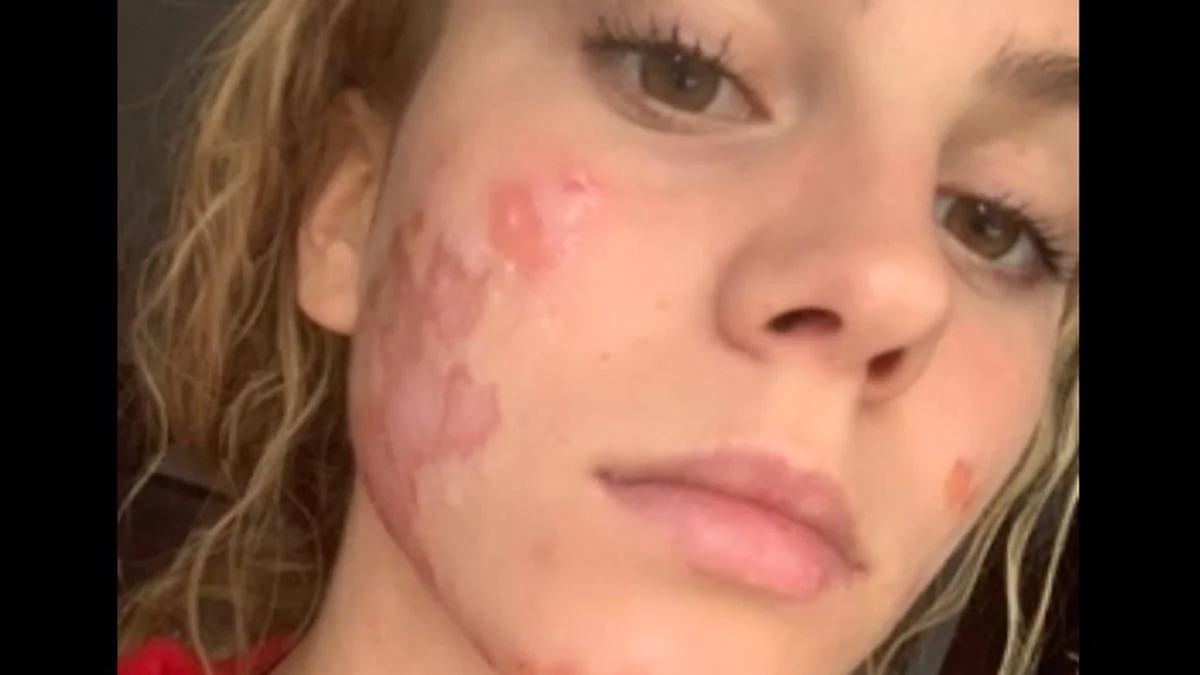 „GNTM hat mich krank gemacht“: Simone teilt Schock-Foto auf Instagram