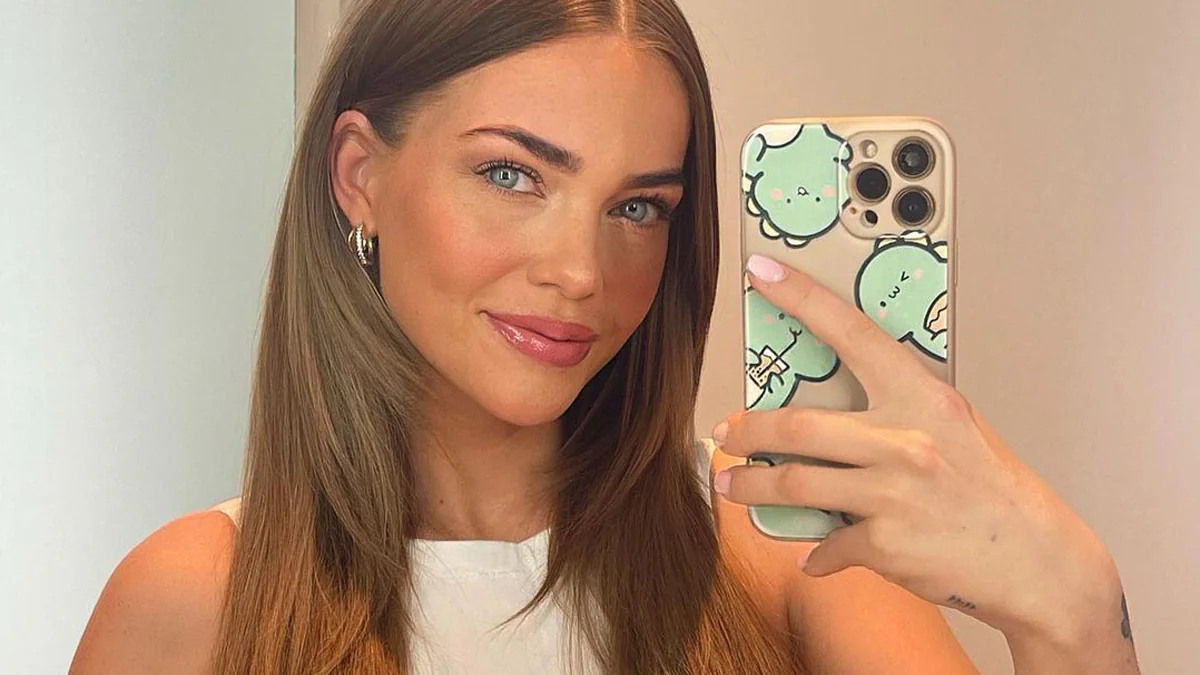 Laura Maria Rypa mit Geständnis: Diese Beauty-Eingriffe hat sie machen lassen
