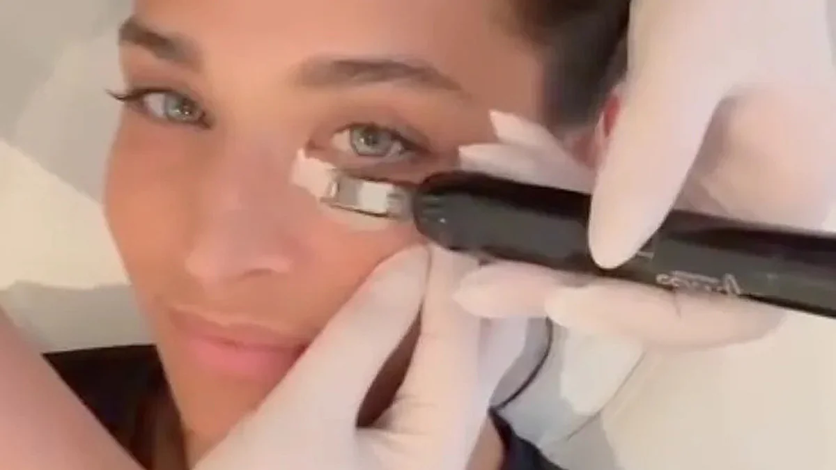 Amira Pocher gesteht Beauty-Eingriff: Fans sind auf Instagram live dabei