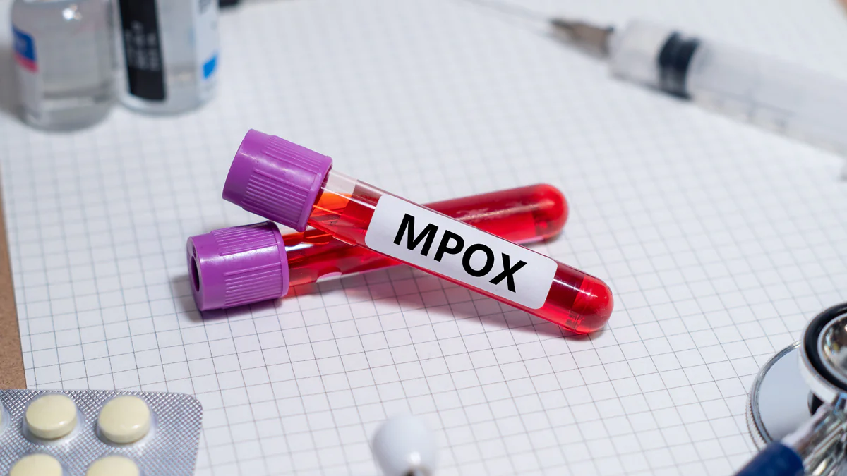 Wegen neuer Mpox-Variante: WHO ruft weltweite Notlage aus