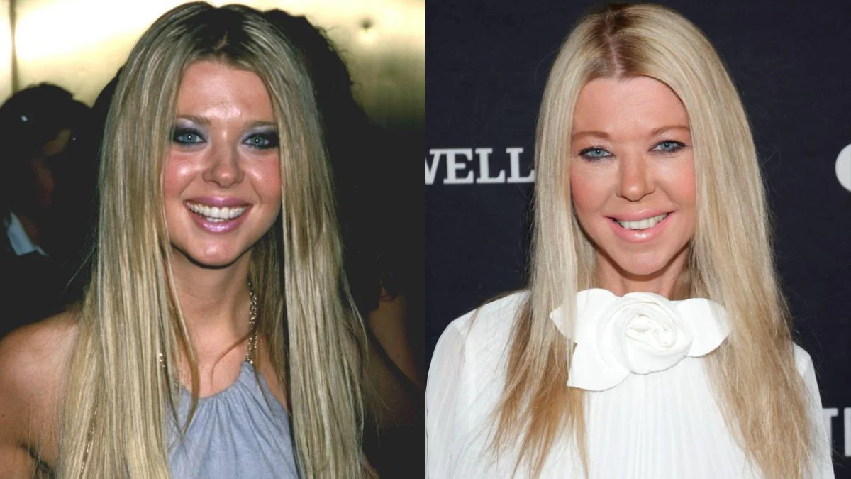 Einst schöne Promis: So sehen sie heute nicht mehr aus