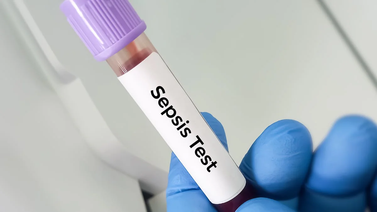 Grippeverlauf verschlechtert sich? An diesen Symptomen erkennt man eine Sepsis