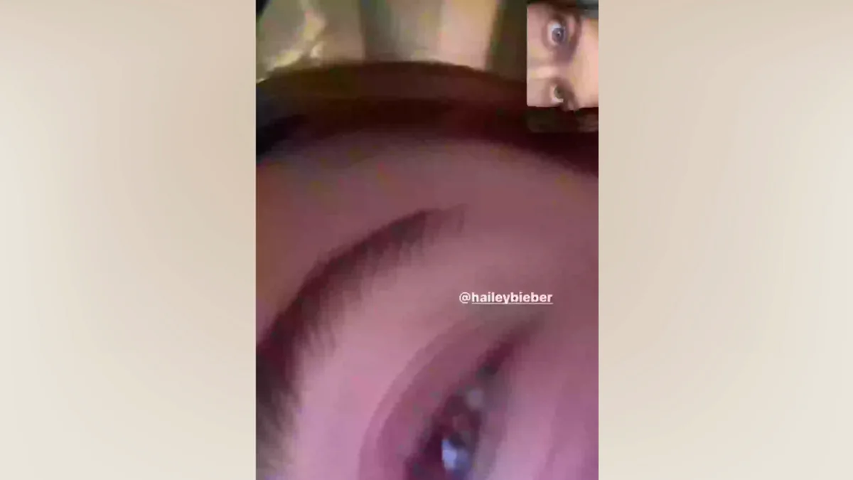 Kylie Jenner postet Bild auf Instagram und verliert 1 Million Follower