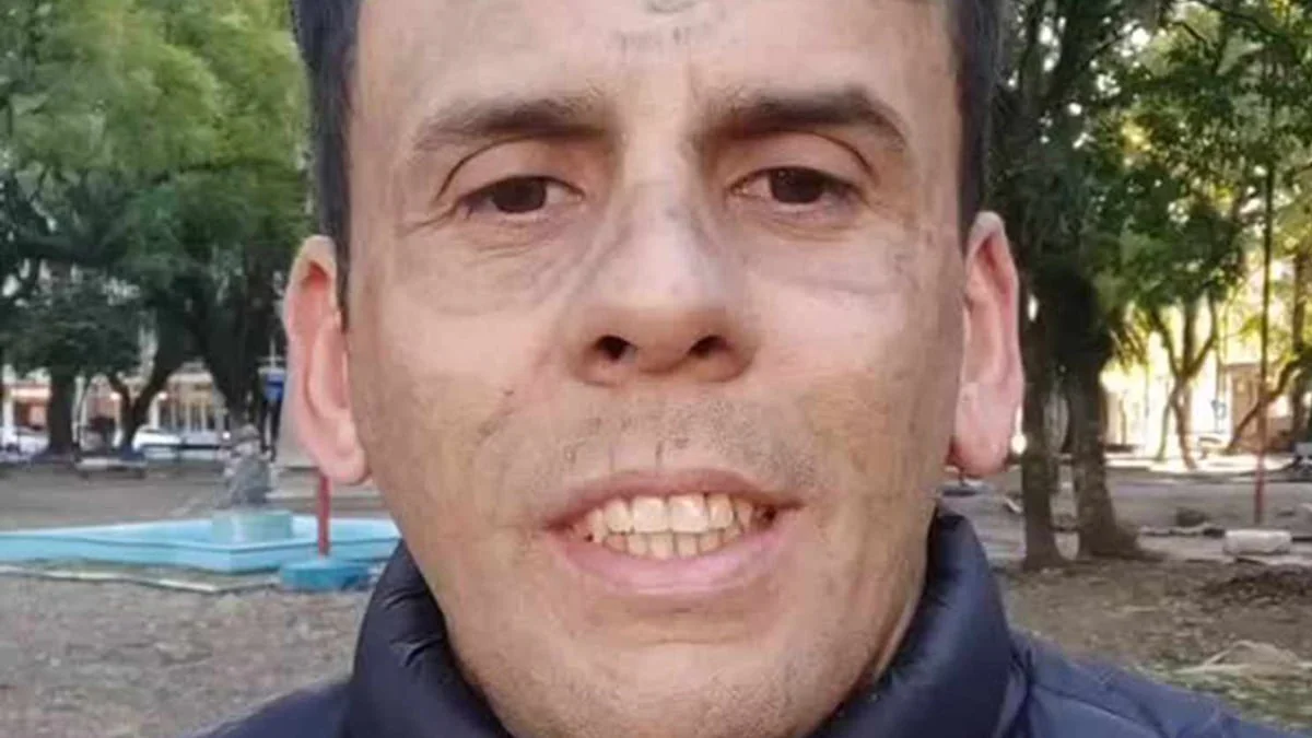 Leandro de Souza lässt sich 170 Tattoos entfernen – „dreimal schmerzhafter als Stechen“