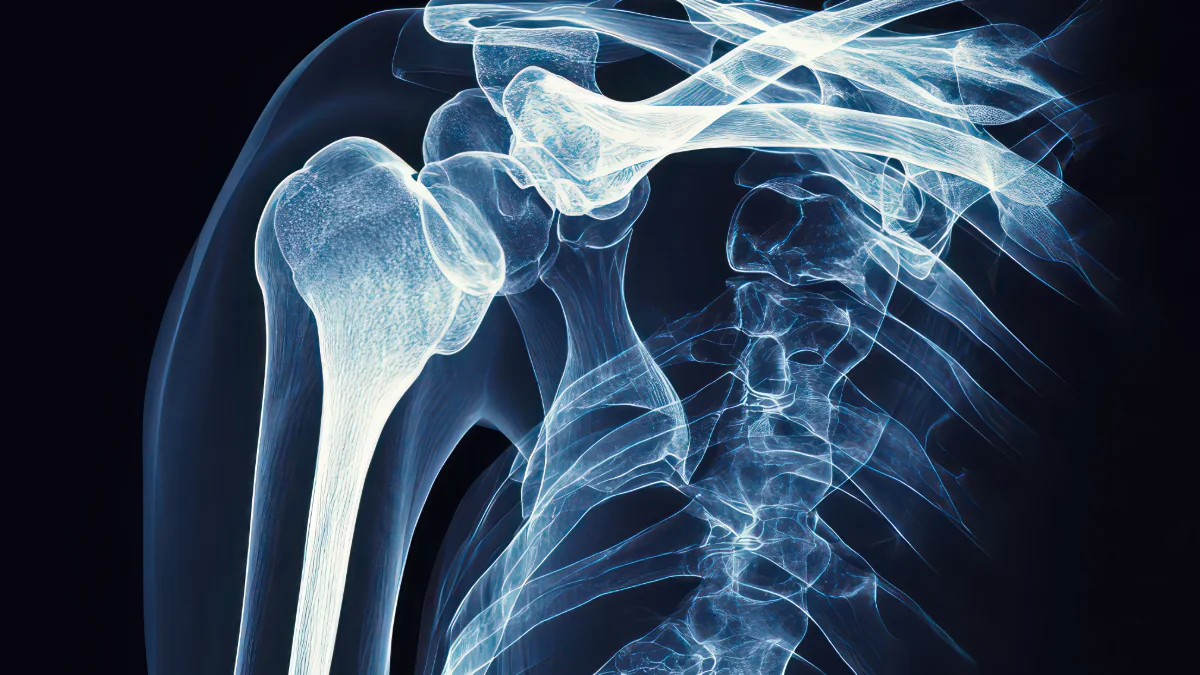 Arzt erklärt: Deshalb brechen sich manche Menschen nie ihre Knochen